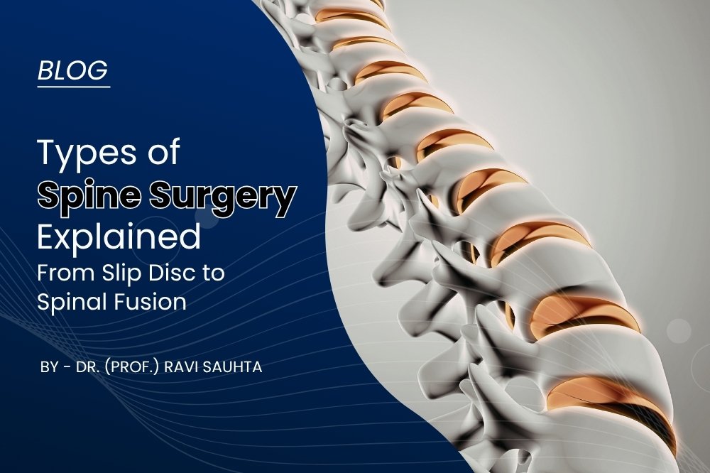 Illustration of human spine structure explaining types of Spine Surgery in Gurgaon by Dr. (Prof.) Ravi Sauhta