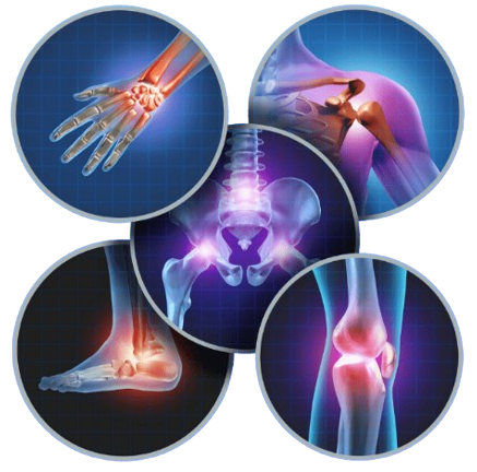 Multiple joint pain areas including hand, hip, knee, and ankle highlighting ORTHOPAEDIC ONCOLOGY – Advanced Bone Tumor and Limb Salvage Surgery in Gurgaon by Dr. (Prof.) Ravi Sauhta
