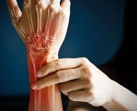 Hand and wrist pain with highlighted bones indicating need for Hand and Wrist Surgery in Gurgaon by Dr. (Prof.) Ravi Sauhta