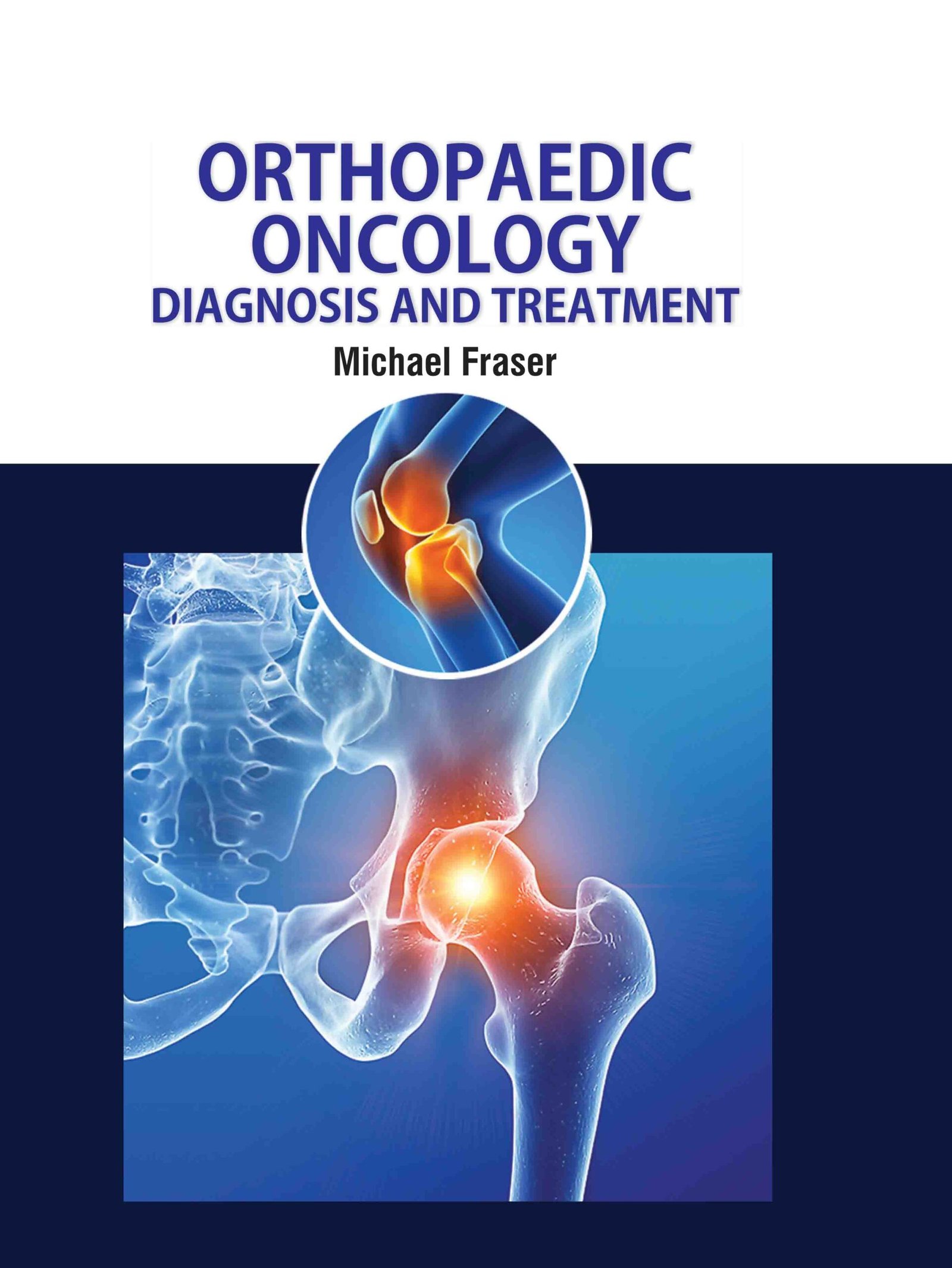 Hip joint X-ray highlighting tumor and pain area representing Orthopedic Oncology in Gurgaon by Dr. (Prof.) Ravi Sauhta