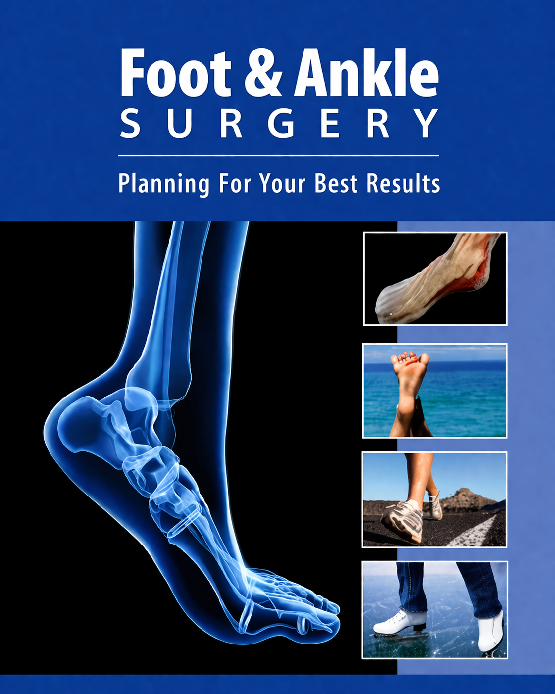 Foot and ankle joint anatomy illustration highlighting conditions treated with Foot & Ankle Surgery in Gurgaon by Dr. (Prof.) Ravi Sauhta