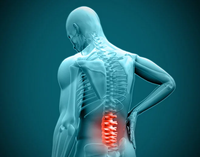 3D illustration of spine with lower back pain highlighting need for Osteoporosis Treatment in Gurgaon by Dr. (Prof.) Ravi Sauhta
